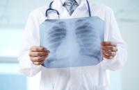 Concorsi tecnico di radiologia